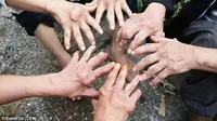 Warga Sekampung Derita Penyakit Aneh yang Bikin Kaku dan Cacat