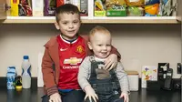 Christopher (5) dan Alexander (18 bulan) hanya bisa makan  kentang, ubi manis, pisang, serta kue dan biskuit yang terbuat dari tepung jagung  (Foto: Daily Mail)