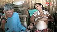 Seorang pasien miskin ditolak ketika berobat di rumah sakit umum di Situbondo, Jawa Timur. Rumah sakit berdalih tak ada dokter yang menangani penyakit pasien. 