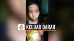 vertical keluar darah
