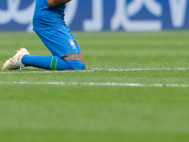 Ini Alasan Kenapa Siku Dan Lutut Orang Dewasa Cenderung Berwarna Lebih Gelap Global Liputan6 Com