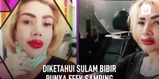 VIDEO: Efek Samping Sulam Bibir Seperti Barbie Kumalasari