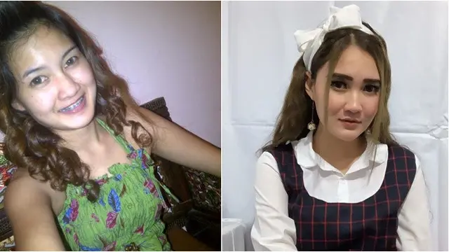 Beda Gaya 7 Pedangdut Tanah Air Sebelum dan Sesudah Terkenal, Bikin Pangling