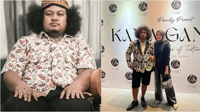 6 Beda Penampilan Artis Sebelum dan Sesudah Sakit Diabetes, Jadi Lebih Kurus