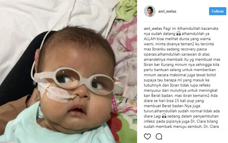 Anak kedua Asri Welas usai menjalani operasi katarak [foto: instagram/asri_welas]