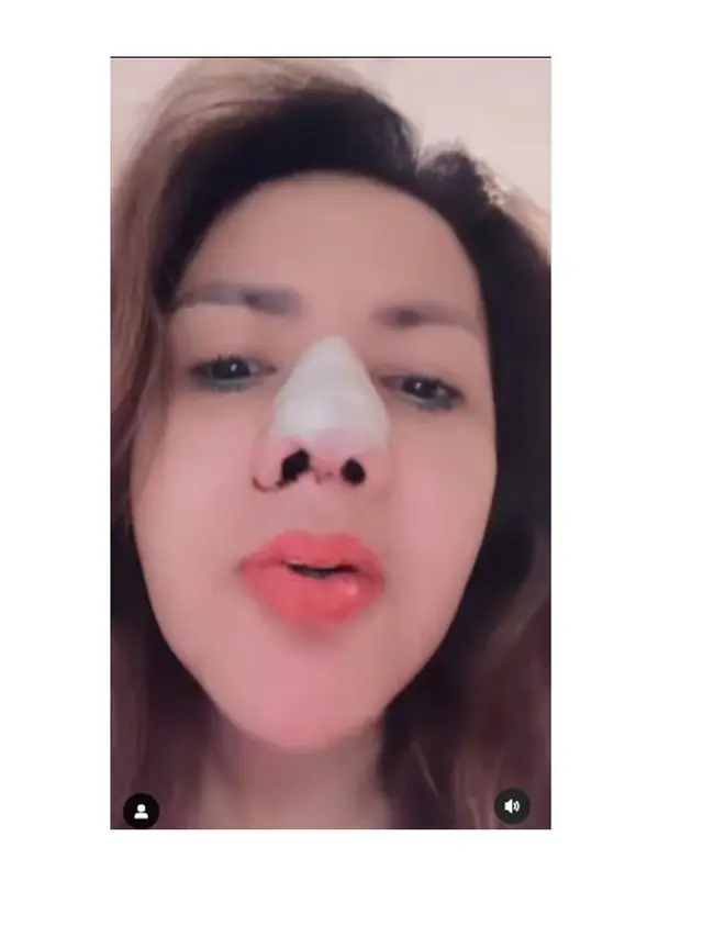 Kembali Jalani Operasi Hidung, Ini 6 Potret Terbaru Barbie Kumalasari