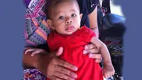 Satu dari ribuan gizi buruk di Banten, ditemukan di Kota Serang. Balita tersebut bernama Rania Putri yang berusia 5 bulan. 