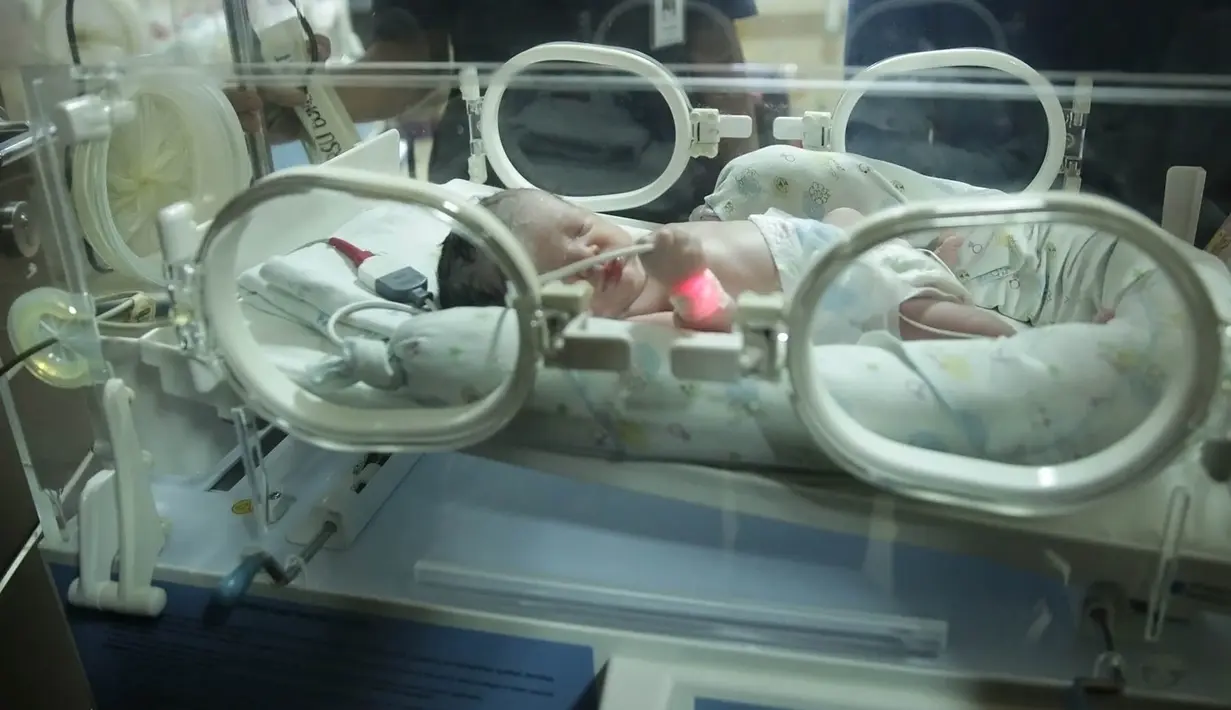 Proses kelahiran caesar harus ditempuh lantaran dalam rahim ada pendarahan. Jadi proses kelahiran dipercepat dari yang rencananya pada minggu depan. Meski dari segi usia kehamilannya telah 9 bulan. (Bambang E. Ros/Bintang.com)