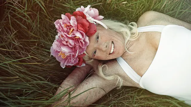 [Bintang] 5 Potret Gadis Bersisik yang Kini Jadi Ratu Kecantikan