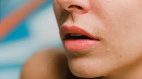 7 Cara Mengatasi Bibir Kering dan Pecah-Pecah