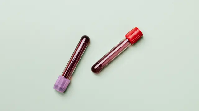 Ciri-ciri kolesterol tinggi