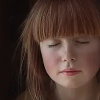 Ilustrasi kulit wajah kemerahan (Foto: Pixabay/pezibear)