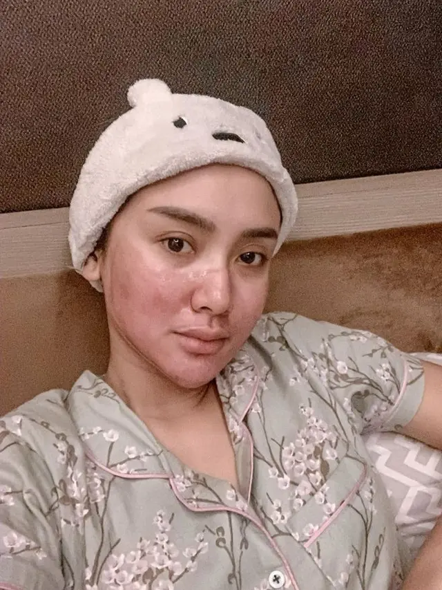 Potret 6 Penyanyi Dangdut Tanpa Makeup, Muka Bantal Jadi Sorotan