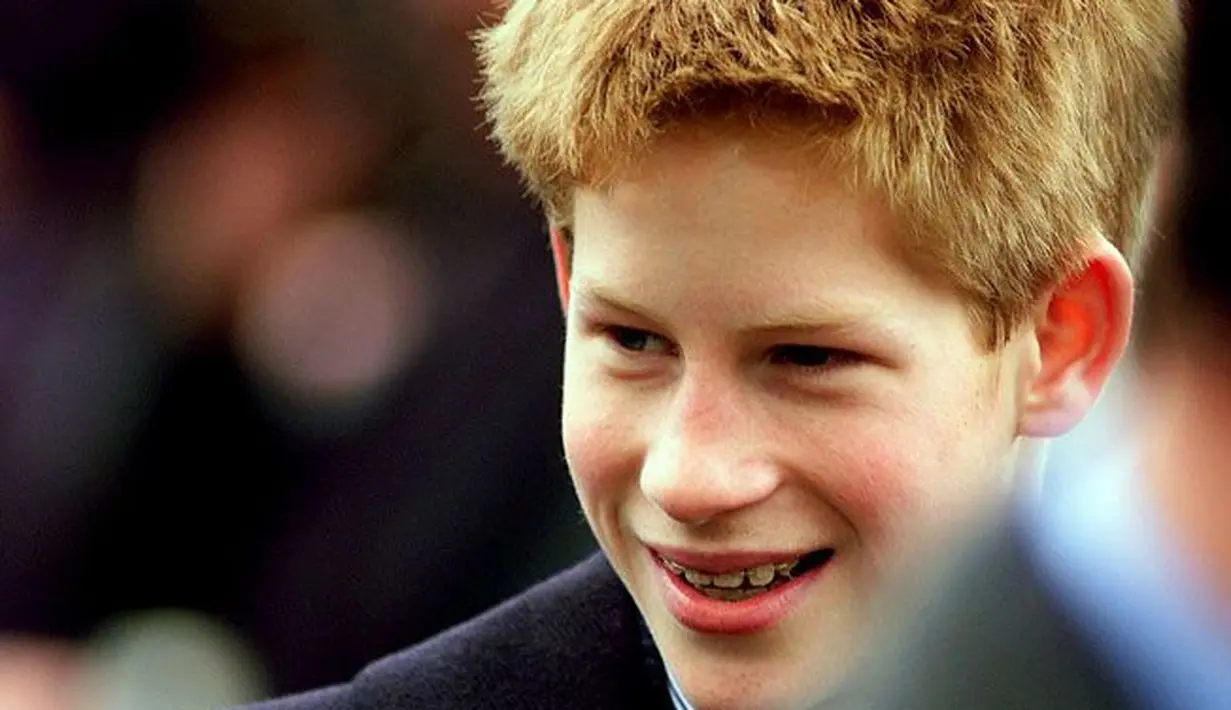 Begini nih penampilan Prince Harry waktu memakai kawat gigi di masa remaja. (Pinterest)