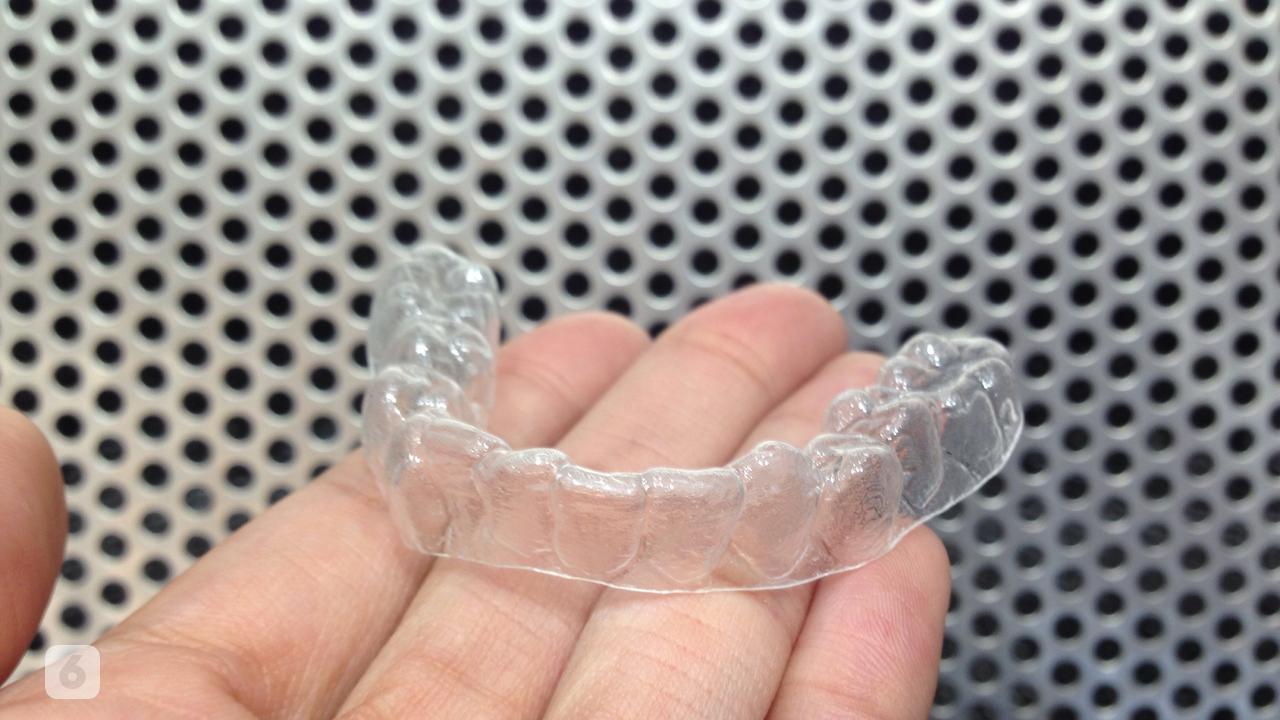 Solusi Merapikan Gigi dengan Teknologi Clear Aligner