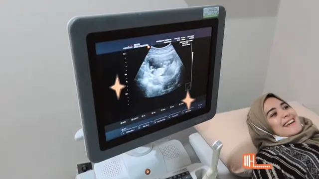 Hamil Anak Pertama, Ini 6 Momen Vebby Palwinta dan Razi Bawazier Cek Kandungan