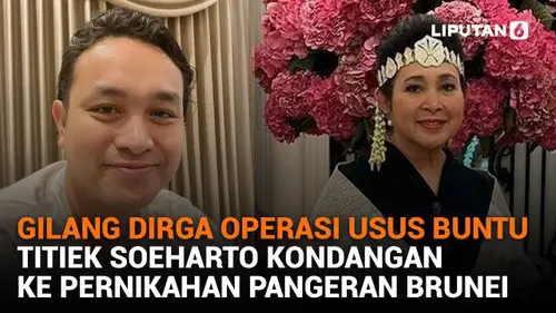 Gilang Dirga Operasi Usus Buntu, Titiek Soeharto Kondangan ke Pernikahan Pangeran Brunei