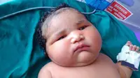 Bayi Raksasa Lahir dengan Bobot Nyaris 7 Kg