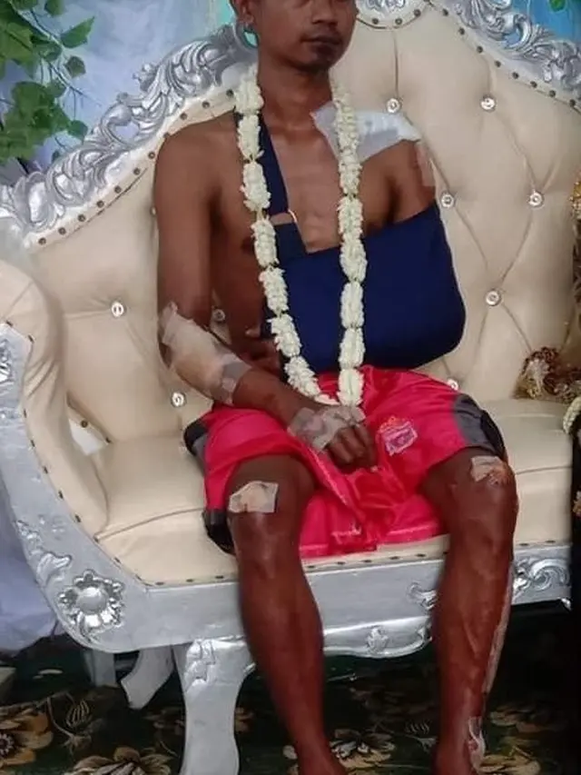 Viral Potret Mempelai Pria Dengan Badan Penuh Luka, Ini 4 Fakta Dibaliknya. (Sumber: Twitter/br0wski)
