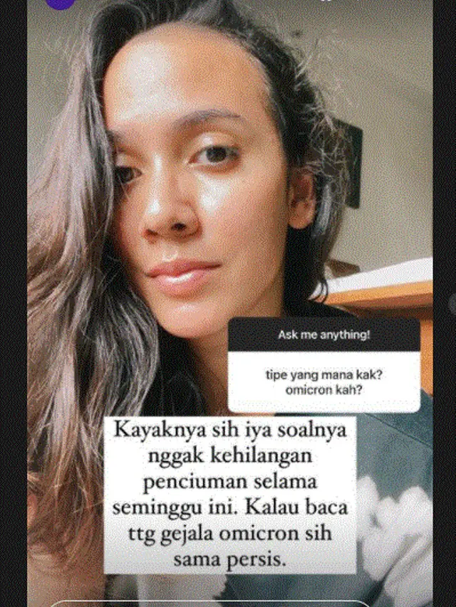 Nadine Alexandra positif terpapar covid-19 diduga Omicron