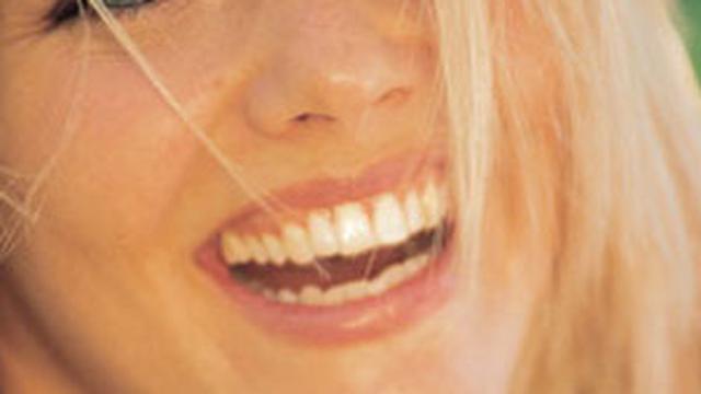 Cara Memutihkan Gigi