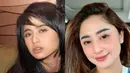 Dewi Perssik sempat diduga operasi plasti di bagian dagu dan hidung. Hal itu dikarenakan tiba-tiba dagunua menjadi lancip dan hidung semakin mancung. Tapi Dewi Perssik membantah lakukan oplas dan bilang dia hanya melakukan treatment wajah. (Liputan6.com/IG/dewiperssik9)
