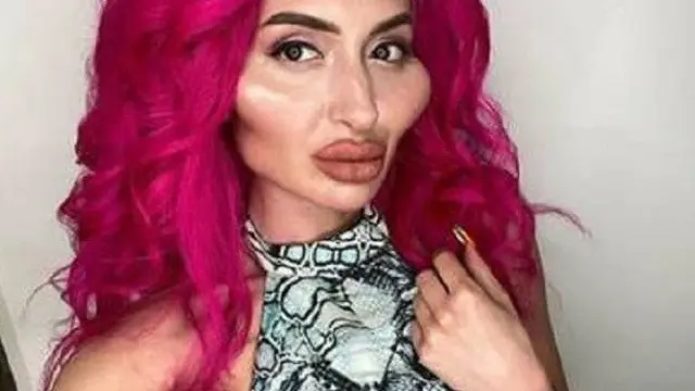 wanita filler wajah sendiri