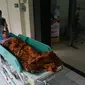 Terapi untuk Sulami si Manusia Kayu (Liputan6.com/Fajar Abrori).