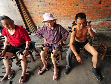 Sejumlah pasien menjalani terapi bekam tradisional di sebuah klinik di Pujiang County, Chengdu, Tiongkok (10/8). Terapi bekam telah menjadi salah satu pengobatan warisan leluhur bangsa Tiongkok. (REUTERS)