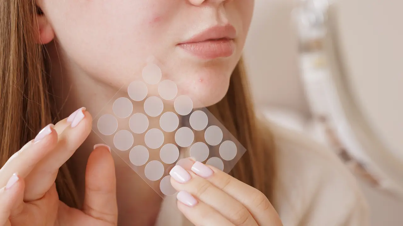 Jangan Asal Tempel! Ini Cara Pakai Acne Patch Biar Hasilnya Maksimal