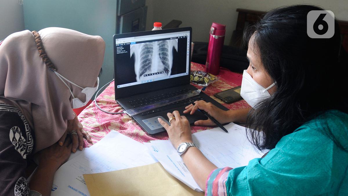 Tuberkulosis Masih Mengancam! 14 Orang Meninggal Tiap Jam di Indonesia karena TBC
