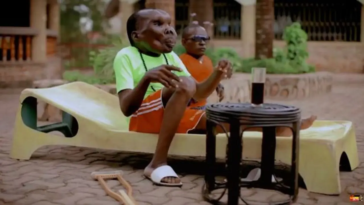 [Bintang] Cacat Wajah, Pria Uganda Ini Sukses Jadi Pop Star di Youtube!