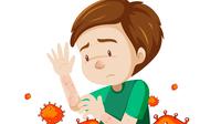 Ilustrasi Monkeypox atau cacar monyet (brgfx/Freepik)