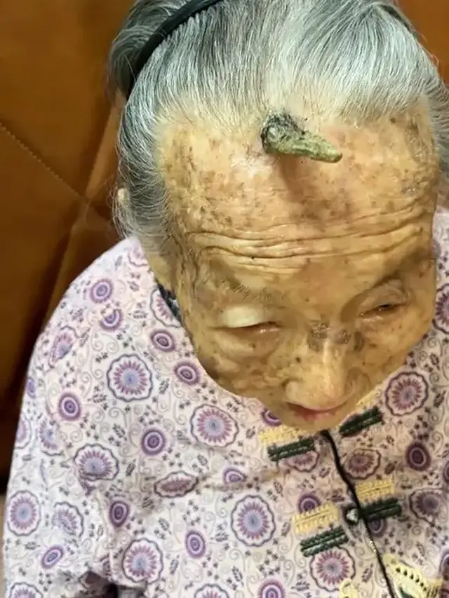 Fenomena Manusia Bertanduk