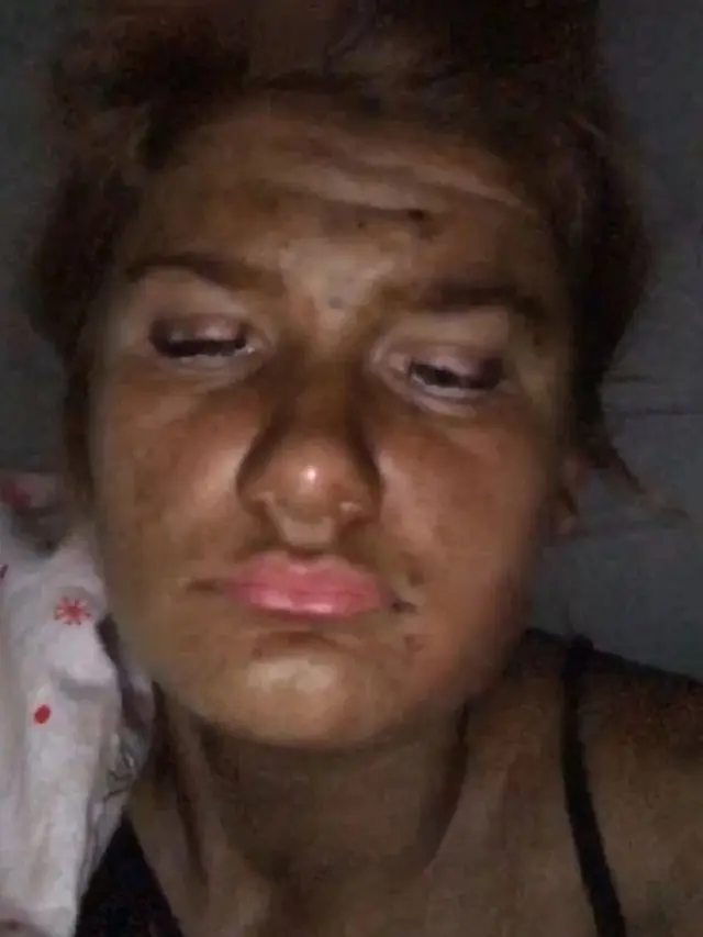Salah Pakai Krim Tanning, Wanita Ini Terlihat Seperti Fiona ‘Shrek’