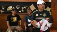 Bupati Purwakarta Dedi Mulyadi menggendong bayi penderita mikrosefalus, Jumat (21/10/2016). (Abramena/Liputan6.com)