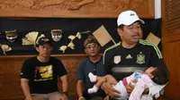 Tak Mampu Bayar Pengobatan, Ini Fasilitas Warga Purwakarta  