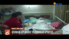 Sekujur tubuh bocah ini alami luka bakar serius akibat terkena cairan spiritus saat bermain dengan teman-temannya.