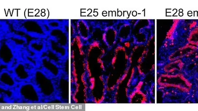 Gambar ini menunjukkan sel ginjal manusia (fluoresensi merah) di dalam embrio dari jarak dekat dibandingkan dengan embrio babi