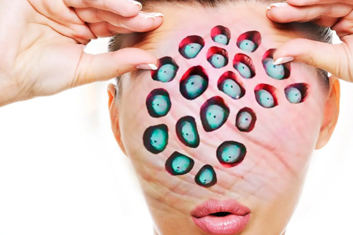 [Bintang] Si Trypophobia Nggak Akan Berani Lihat 10 Foto Ini