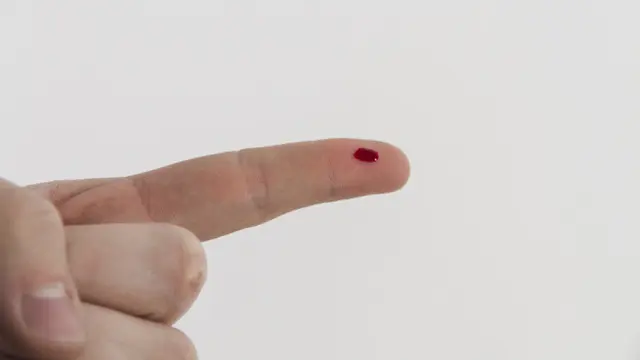 Membutuhkan Waktu Lebih Lama dalam Penyembuhan Luka