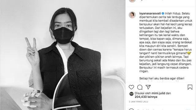 Isyana Sarasvati Alami Cedera Tangan, Sempat Khawatirkan Karier Bermusiknya. (instagram.com/isyanasarasvati)