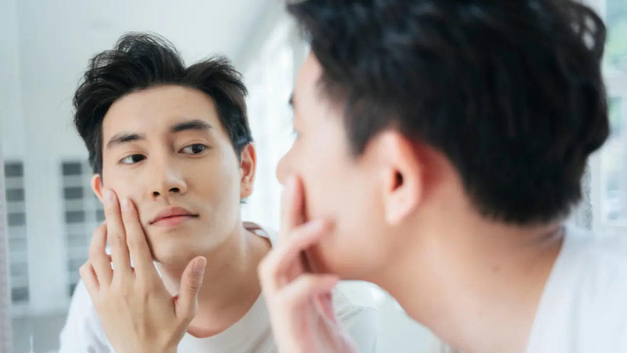 Jerawat Sering Muncul Pada Wajah? Ketahui 4 Penyebab Utamanya