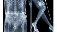 Unik, Fotografi dari  Sinar X-Ray Karya Nick Veasey