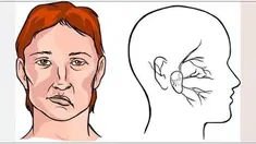 Penyakit stroke memang tidak bisa diabaikan. Kejadiannya yang kerap kali mendadak membuat penderitanya sering tidak dapat terselamatkan.
