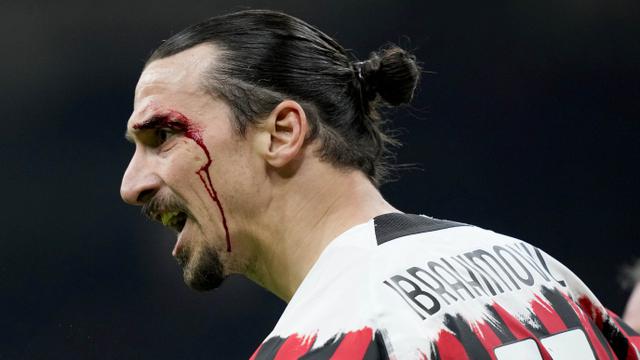 Foto: Zlatan Ibrahimovic Berdarah-Darah, AC Milan Ditahan Imbang Bologna di Liga Italia