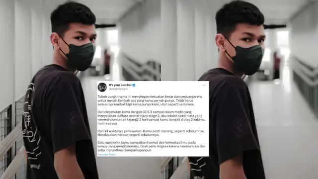 Jonathan Latumahina Menyebut Bahwa David Ozora Mengalami Diffuse Axonal Injury (DAI). Di Amerika Serikat, DAI yang Merupakan Jenis dari Cedera Otak Traumatik Menjadi Penyebab Kematian pada Dewasa Muda. (twitter.com/seeksixsukc)