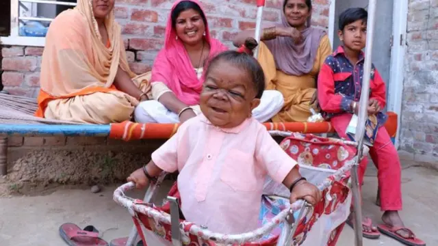 [Bintang] Mengidap Penyakit Langka, Pria Berusia 23 Tahun Miliki Fisik Seperti Bayi 1 Tahun