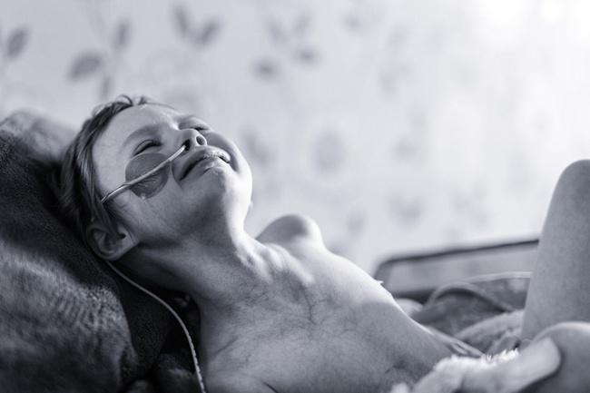 Potret Jessica yang begitu memilukan saat ia melawan sakit karena kanker di tubuhnya | Photo: Copyright metro.co.uk