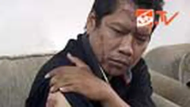 Polisi Korban Cairan Kimia Lapor ke Polda
